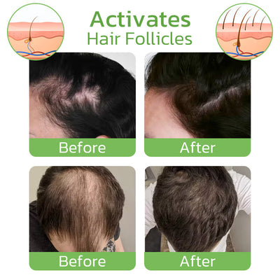 GroeiPlus™ - Voedende Gember Spray (50% KORTING)