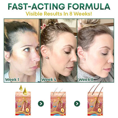 1+1 GRATIS | HairFix™ - Haarserum voor haargroei