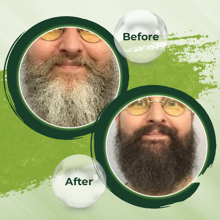 HerbCare™ Shampoo Bar | Krijg je kleur & levendigheid terug! Weg met grijze haren & haarverlies!