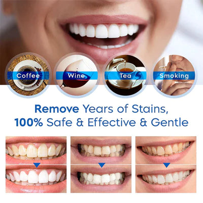 PureSmile™ Organic Teeth Whitening