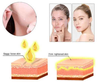 InstantLift™ 24K Protein Wire Skin Lifting & Rejuvenation Set