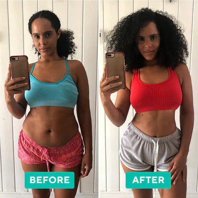 Ultrafit | Ultrasonic Vet & Cellulitis Brander