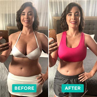 Ultrafit | Ultrasonic Vet & Cellulitis Brander