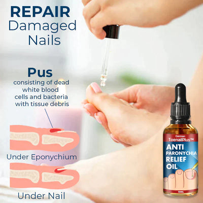 NailPlus™ Anti Paronychia Olie